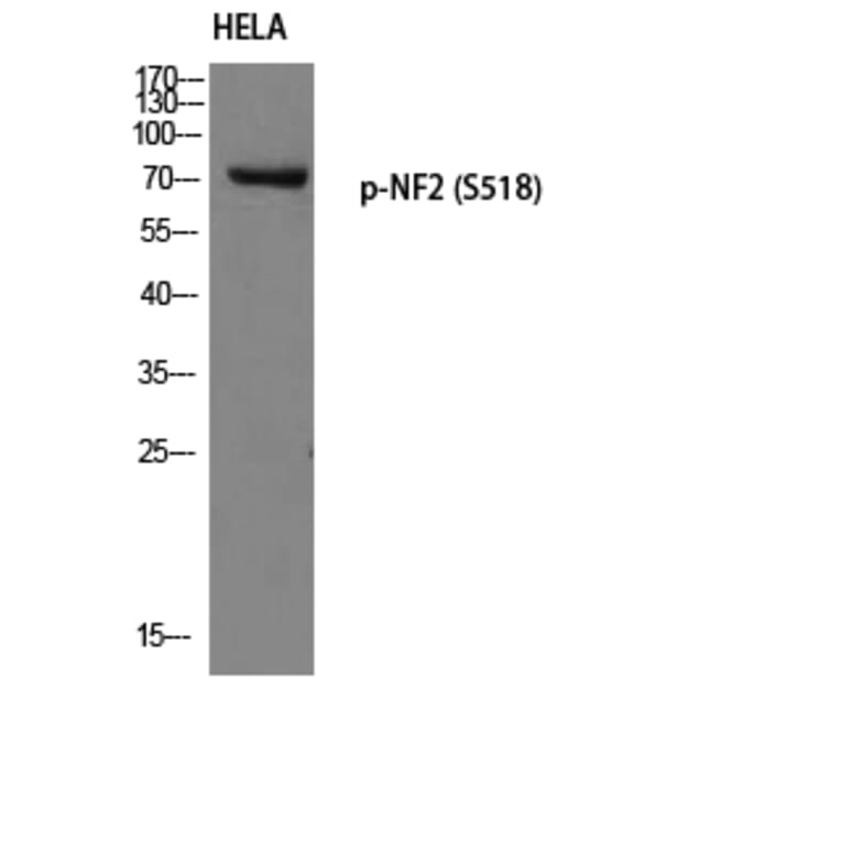 Western Blot - Anti-Merlin (phospho Ser518) Antibody (A7150) - Antibodies.com