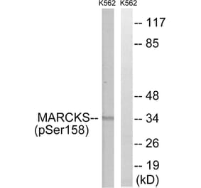 Western Blot - Anti-MARCKS (phospho Ser158) Antibody (A7142) - Antibodies.com
