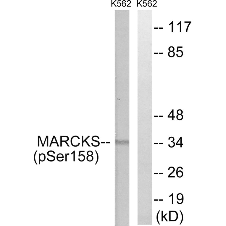 Western Blot - Anti-MARCKS (phospho Ser158) Antibody (A7142) - Antibodies.com