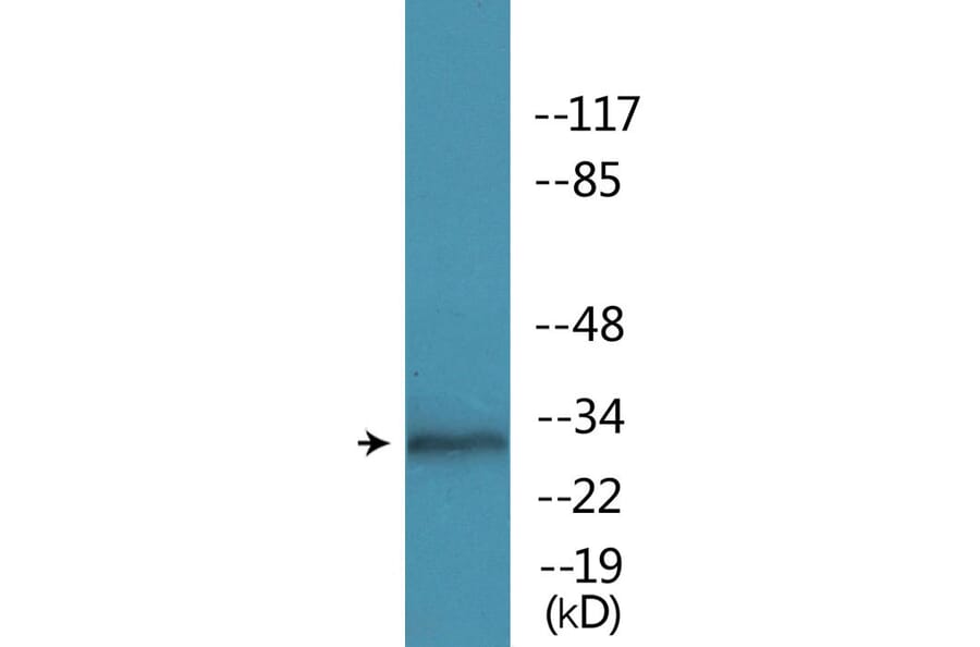 Western Blot - Anti-MARCKS (phospho Ser158) Antibody (P12-1145) - Antibodies.com