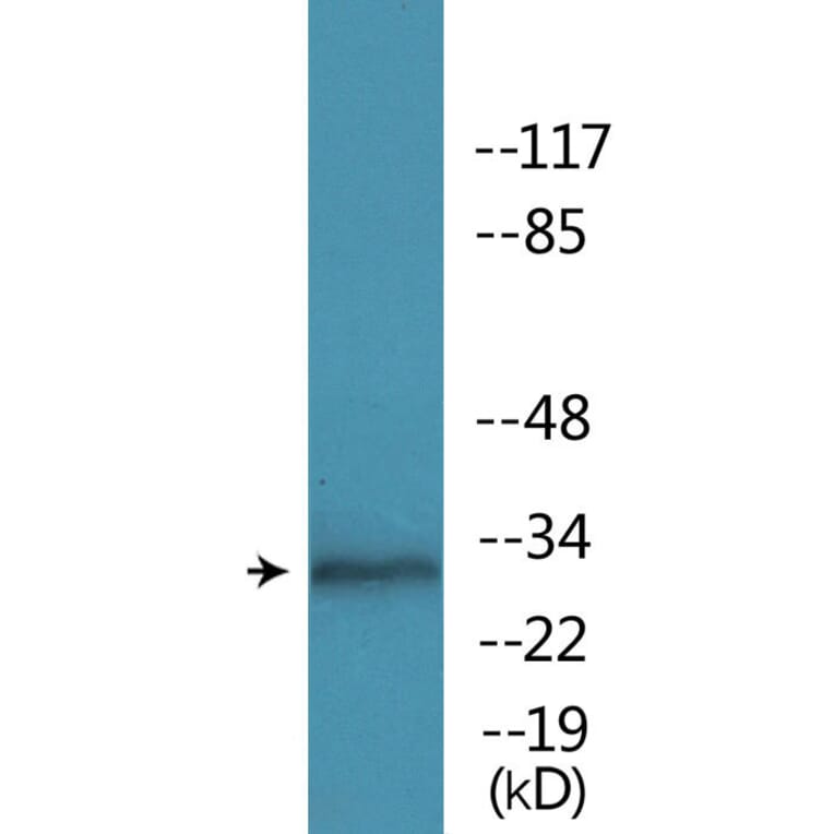 Western Blot - Anti-MARCKS (phospho Ser158) Antibody (P12-1145) - Antibodies.com