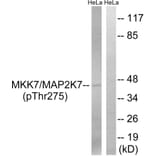 Western Blot - Anti-MAP2K7 (phospho Thr275) Antibody (A8141) - Antibodies.com