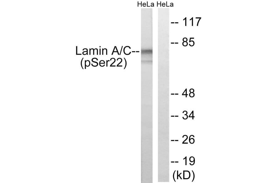Western Blot - Anti-Lamin A (phospho Ser22) Antibody (A8464) - Antibodies.com