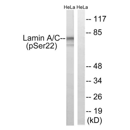 Western Blot - Anti-Lamin A (phospho Ser22) Antibody (A8464) - Antibodies.com