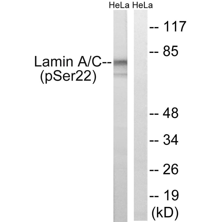 Western Blot - Anti-Lamin A (phospho Ser22) Antibody (A8464) - Antibodies.com