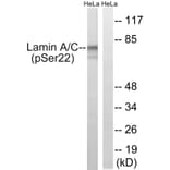 Western Blot - Anti-Lamin A (phospho Ser22) Antibody (A8464) - Antibodies.com