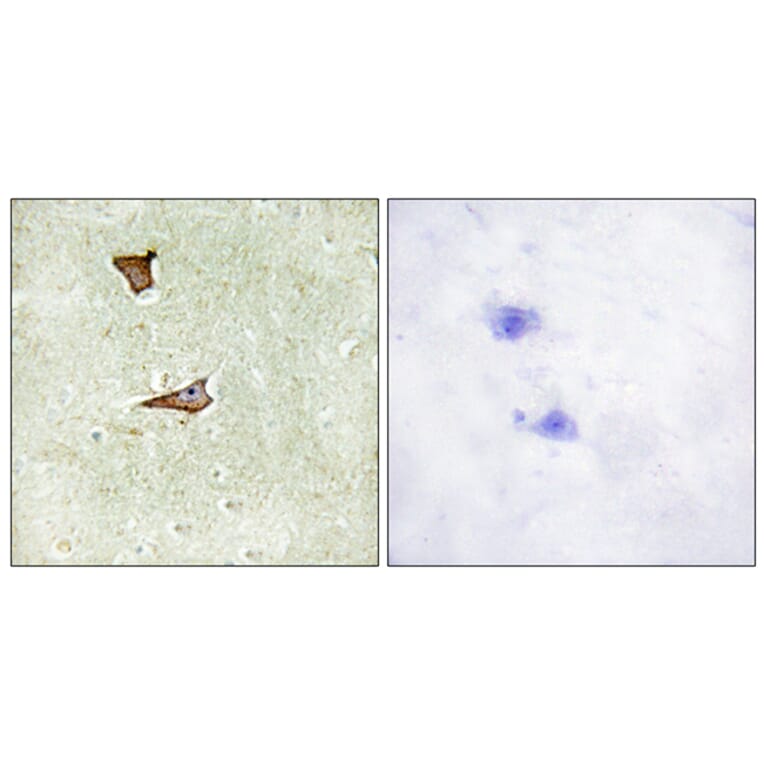 Immunohistochemistry - Anti-IGF2R (phospho Ser2409) Antibody (A1211) - Antibodies.com