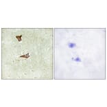 Immunohistochemistry - Anti-IGF2R (phospho Ser2409) Antibody (A1211) - Antibodies.com