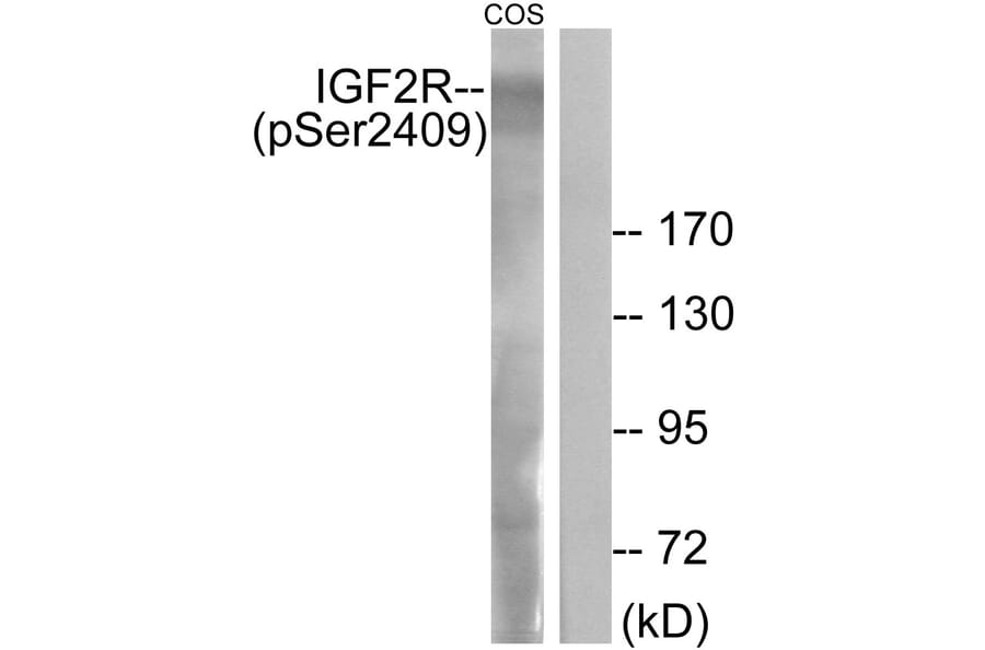 Western Blot - Anti-IGF2R (phospho Ser2409) Antibody (A1211) - Antibodies.com