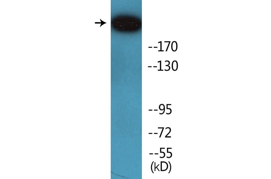 Western Blot - Anti-IGF2R (phospho Ser2409) Antibody (P12-1119) - Antibodies.com