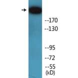 Western Blot - Anti-IGF2R (phospho Ser2409) Antibody (P12-1119) - Antibodies.com