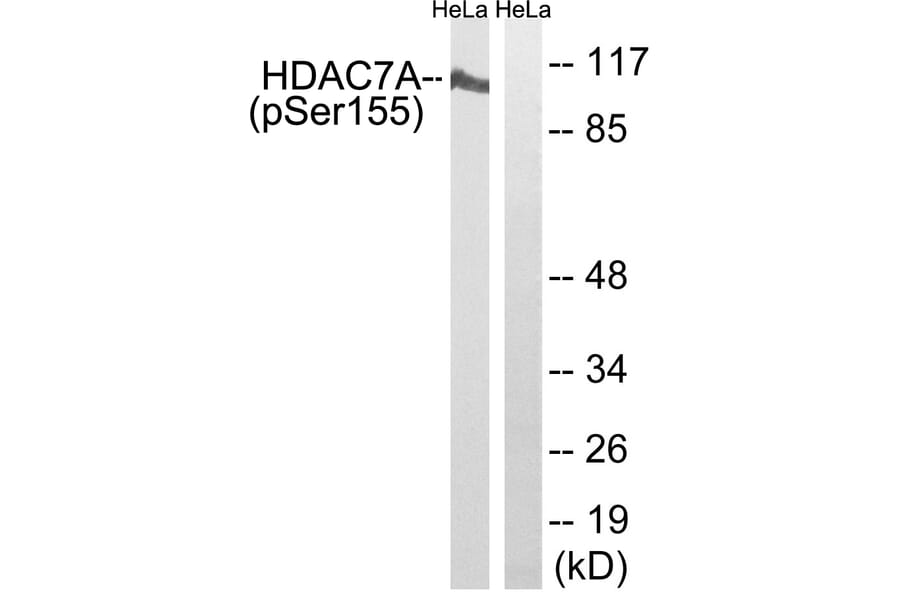 Western Blot - Anti-HDAC7A (phospho Ser155) Antibody (A8511) - Antibodies.com