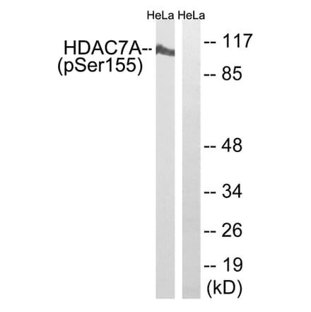 Western Blot - Anti-HDAC7A (phospho Ser155) Antibody (A8511) - Antibodies.com