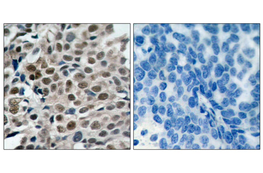 Immunohistochemistry - Anti-FKHRL1 (phospho Ser253) Antibody (A7087) - Antibodies.com