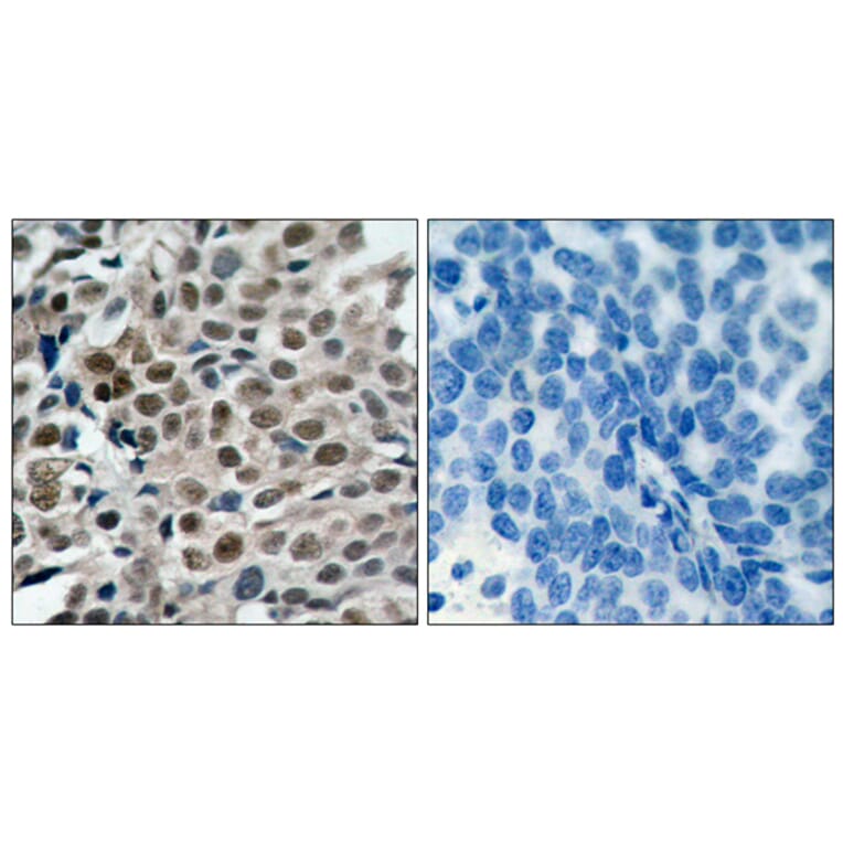 Immunohistochemistry - Anti-FKHRL1 (phospho Ser253) Antibody (A7087) - Antibodies.com