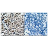 Immunohistochemistry - Anti-FKHRL1 (phospho Ser253) Antibody (A7087) - Antibodies.com
