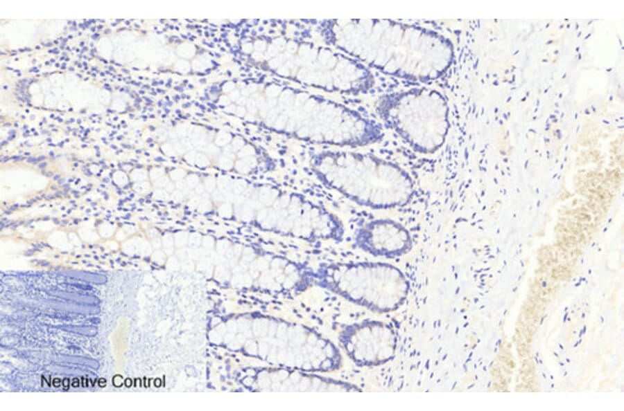 Immunohistochemistry - Anti-FKHRL1 (phospho Ser253) Antibody (A7087) - Antibodies.com
