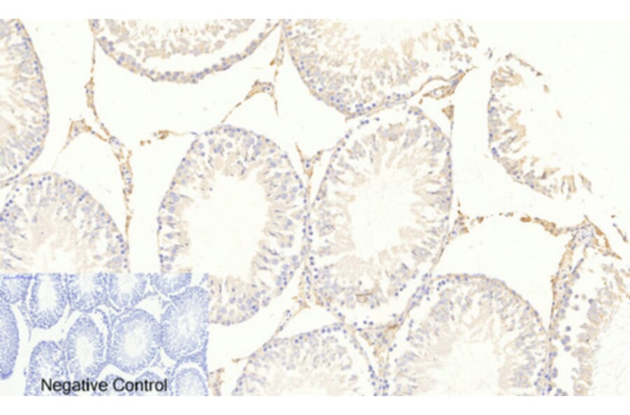Immunohistochemistry - Anti-FKHRL1 (phospho Ser253) Antibody (A7087) - Antibodies.com