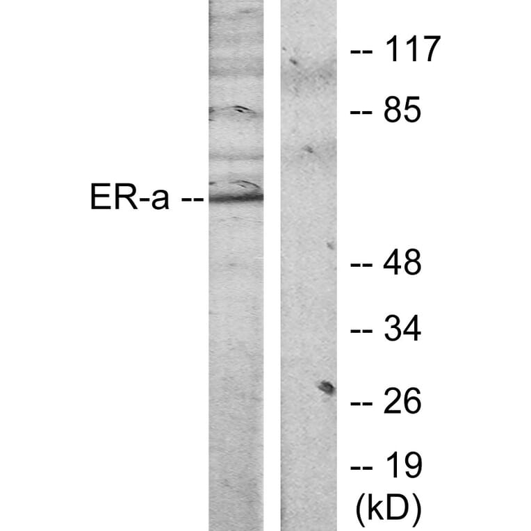 Western Blot - Anti-Estrogen Receptor-alpha Antibody (B7077) - Antibodies.com