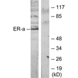 Western Blot - Anti-Estrogen Receptor-alpha Antibody (B7077) - Antibodies.com