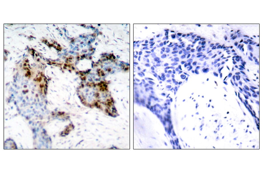 Immunohistochemistry - Anti-Estrogen Receptor-alpha Antibody (B7077) - Antibodies.com