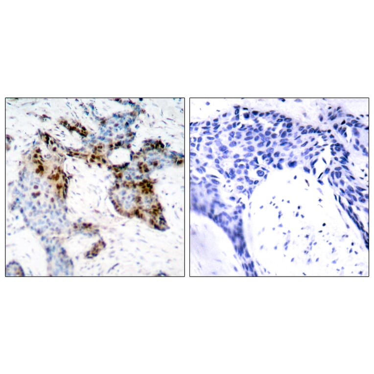 Immunohistochemistry - Anti-Estrogen Receptor-alpha Antibody (B7077) - Antibodies.com