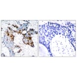 Immunohistochemistry - Anti-Estrogen Receptor-alpha Antibody (B7077) - Antibodies.com