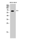 Western Blot - Anti-Estrogen Receptor-alpha Antibody (B7077) - Antibodies.com