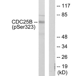 Western Blot - Anti-CDC25B (phospho Ser323) Antibody (A0063) - Antibodies.com