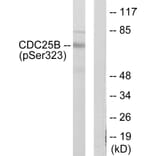Western Blot - Anti-CDC25B (phospho Ser323) Antibody (A0063) - Antibodies.com