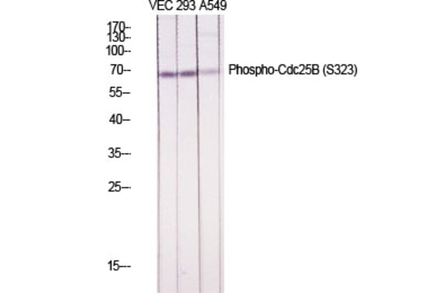 Western Blot - Anti-CDC25B (phospho Ser323) Antibody (A0063) - Antibodies.com