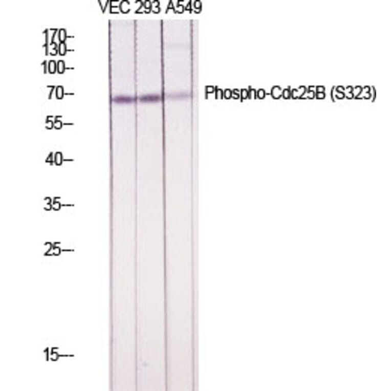 Western Blot - Anti-CDC25B (phospho Ser323) Antibody (A0063) - Antibodies.com