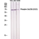 Western Blot - Anti-CDC25B (phospho Ser323) Antibody (A0063) - Antibodies.com