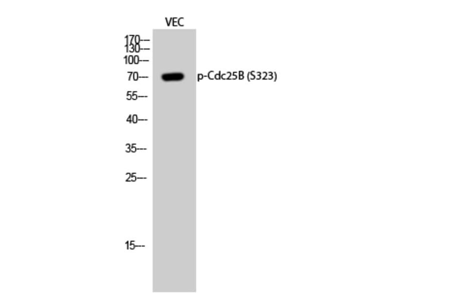 Western Blot - Anti-CDC25B (phospho Ser323) Antibody (A0063) - Antibodies.com