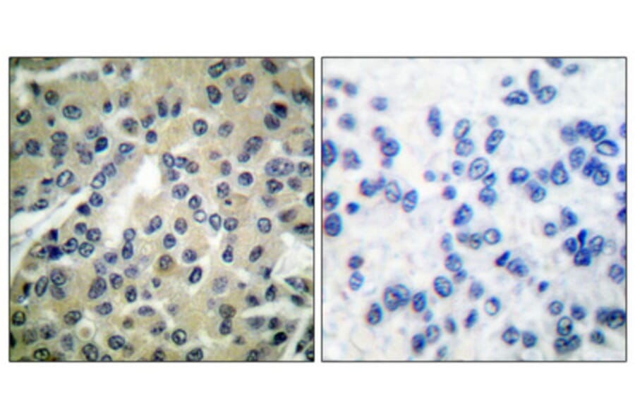 Immunohistochemistry - Anti-CDC25B (phospho Ser323) Antibody (A0063) - Antibodies.com