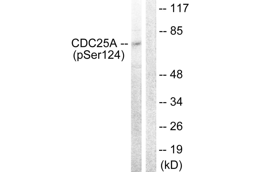 Western Blot - Anti-CDC25A (phospho Ser124) Antibody (A0854) - Antibodies.com