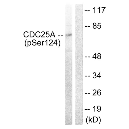 Western Blot - Anti-CDC25A (phospho Ser124) Antibody (A0854) - Antibodies.com