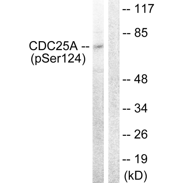 Western Blot - Anti-CDC25A (phospho Ser124) Antibody (A0854) - Antibodies.com