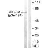 Western Blot - Anti-CDC25A (phospho Ser124) Antibody (A0854) - Antibodies.com
