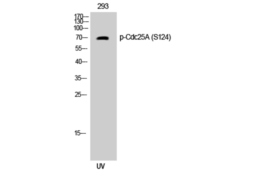 Western Blot - Anti-CDC25A (phospho Ser124) Antibody (A0854) - Antibodies.com