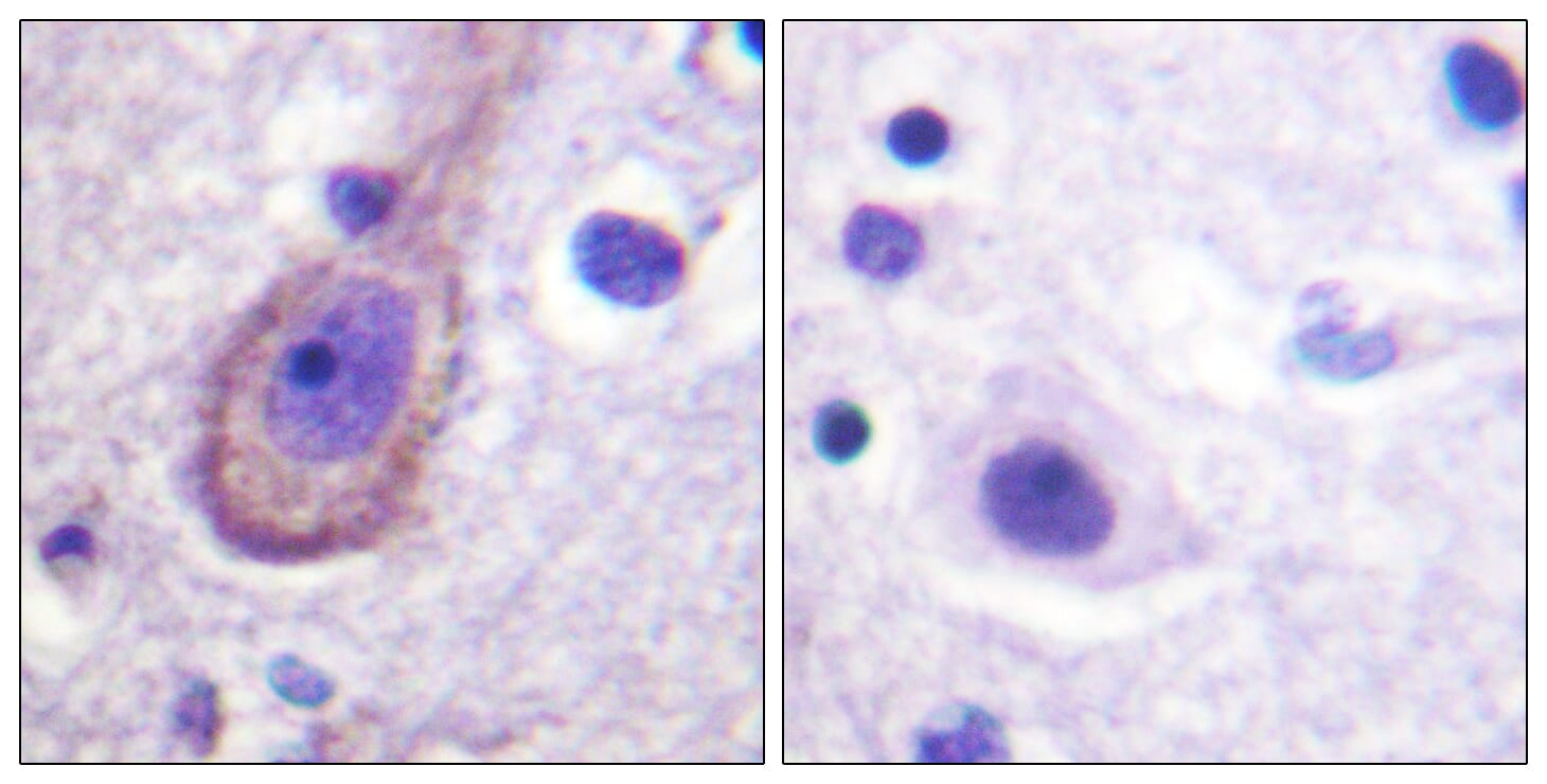 Immunohistochemical analysis of paraffin-embedded human brain using Anti-KCNQ3 (phospho Thr246) Antibody. The right hand panel represents a negative control, where the antibody was pre-incubated with the immunising peptide.