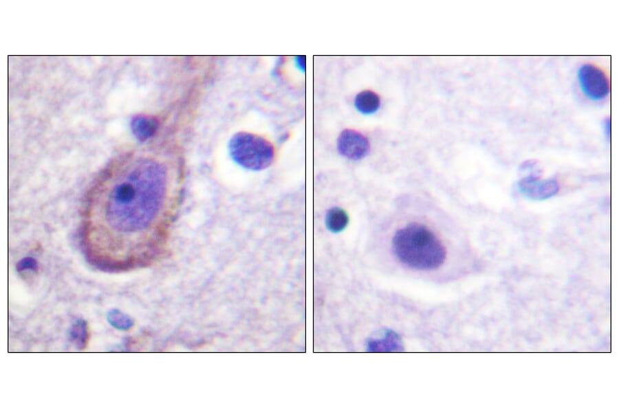 Immunohistochemistry - Anti-KCNQ3 (phospho Thr246) Antibody (A1089) - Antibodies.com