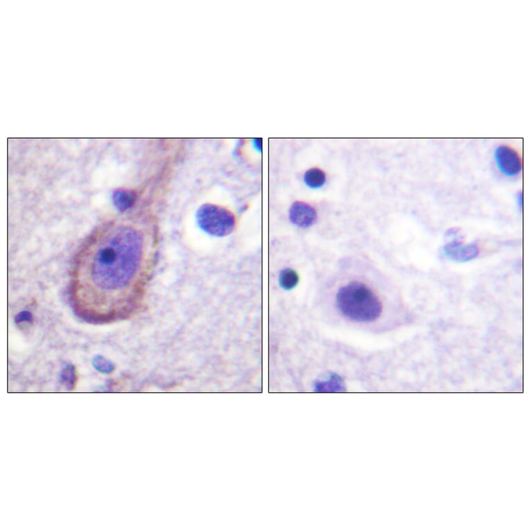 Immunohistochemistry - Anti-KCNQ3 (phospho Thr246) Antibody (A1089) - Antibodies.com