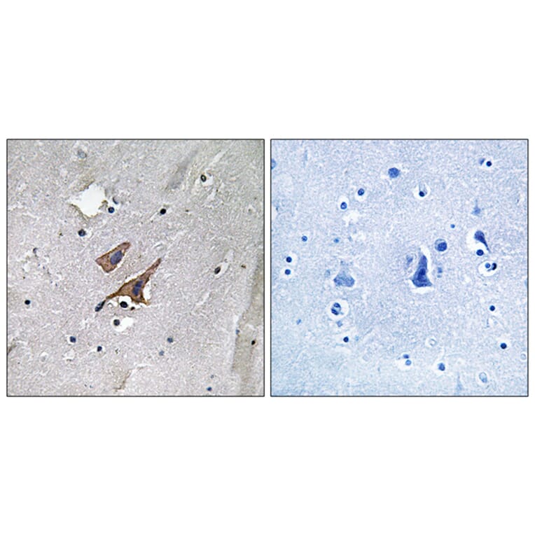 Immunohistochemistry - Anti-TSC2 (phospho Tyr1571) Antibody (A8480) - Antibodies.com