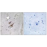 Immunohistochemistry - Anti-TSC2 (phospho Tyr1571) Antibody (A8480) - Antibodies.com