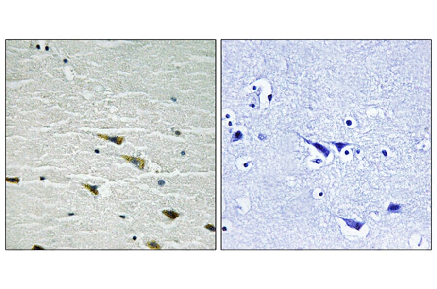 Immunohistochemistry - Anti-Trk A (phospho Tyr757) Antibody (A8194) - Antibodies.com