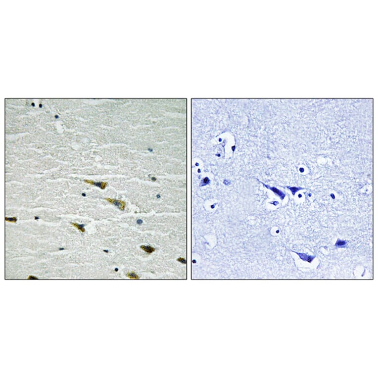 Immunohistochemistry - Anti-Trk A (phospho Tyr757) Antibody (A8194) - Antibodies.com