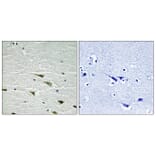 Immunohistochemistry - Anti-Trk A (phospho Tyr757) Antibody (A8194) - Antibodies.com