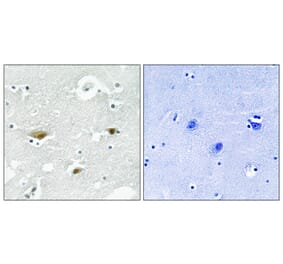 Immunohistochemistry - Anti-STK39 (phospho Ser325) Antibody (A8187) - Antibodies.com
