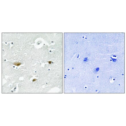 Immunohistochemistry - Anti-STK39 (phospho Ser325) Antibody (A8187) - Antibodies.com